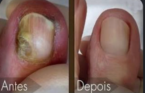 Exemplo visual de unhas