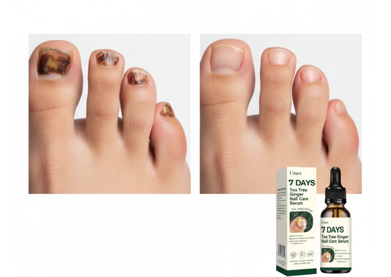 Detalhes do cuidado das unhas