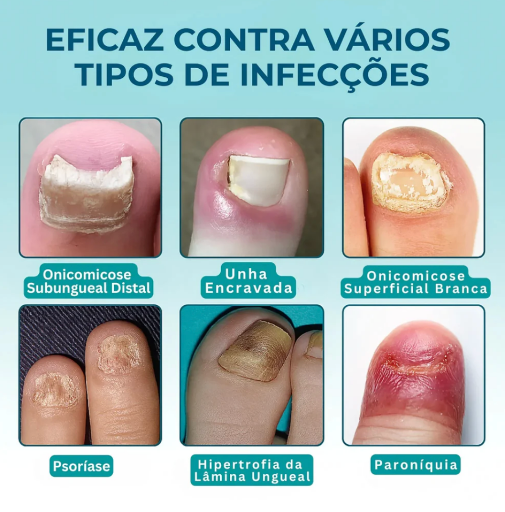 Cuidados com diferentes aparências das unhas