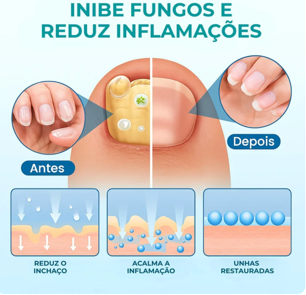 Infográfico de cuidado das unhas